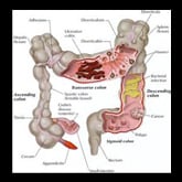 healthy colon diagram